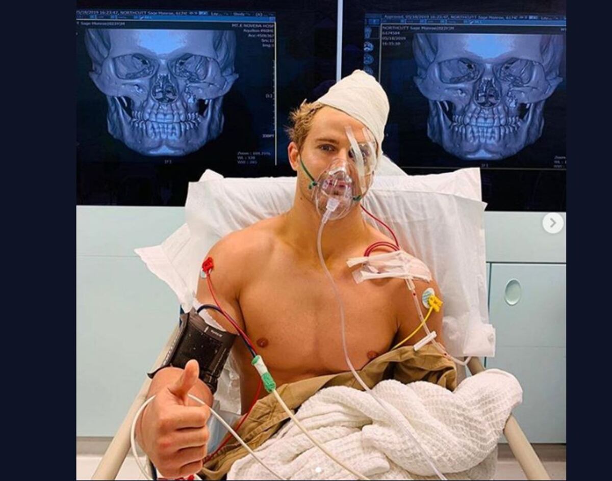 Un puñetazo le dejó 8 fracturas en el rostro | Video