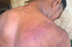 Joven que denunció a policías por golpiza en Las Garzas: ‘Me colocaron un cartucho en la cabeza y me intentaron ahogar’