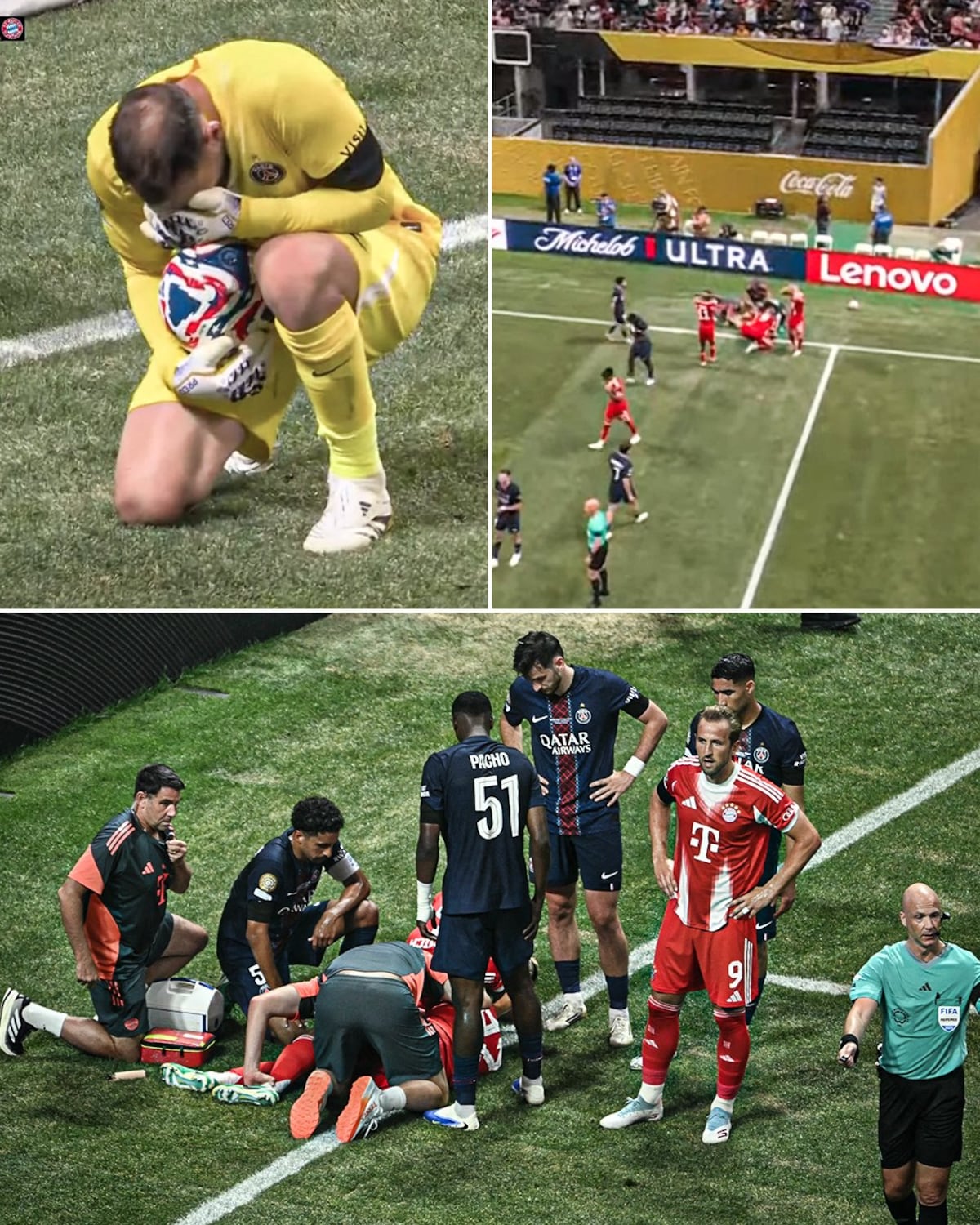 ¡Brutal! Musiala se rompe el tobillo tras choque con Donnarumma