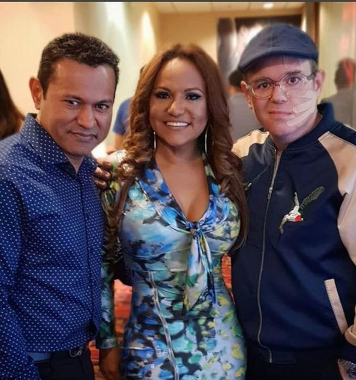 Presentador de TV Alex Medela confirma que sufre parálisis facial