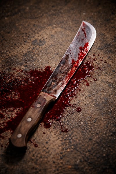 Discusión entre primos termina en horror: sargento pierde el brazo tras ataque con machete