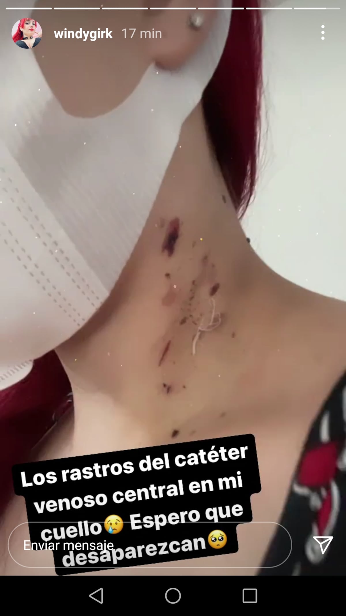 Windy Girk muestra las marcas que le quedaron tras su hospitalización 