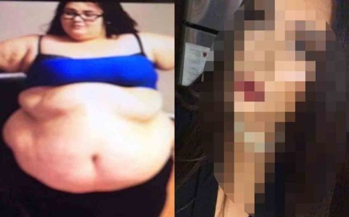 Perdió 80 kilos; se motivó tras casi ahogarse con su refresco