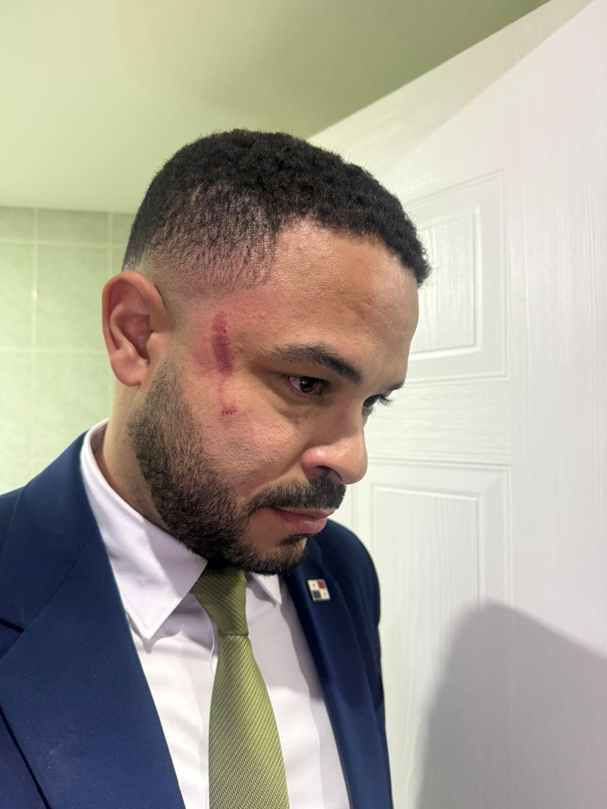 ‘Esto no es político, es personal’. Patio limoso y salseo en la Asamblea Nacional: Bolota pierde el control y  amenaza de muerte a Betserai