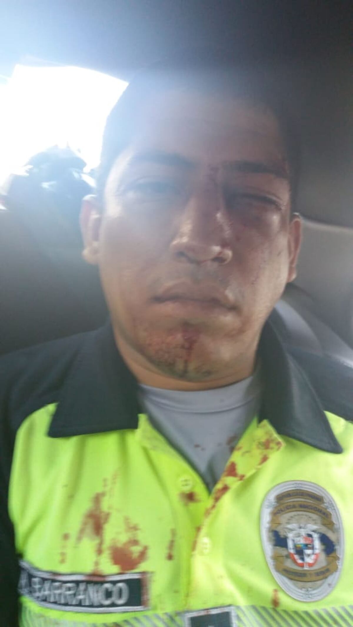 Unidad de la Policía de Tránsito es agredida por conductor de busito pirata