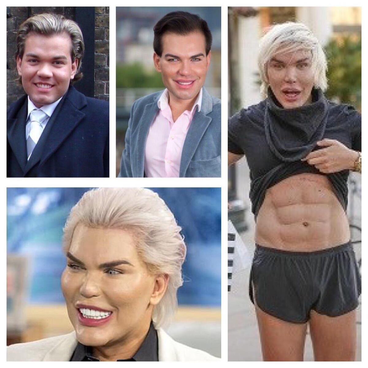 Exceso de cirugías. Arrestan a Ken humano por no parecerse a foto de pasaporte