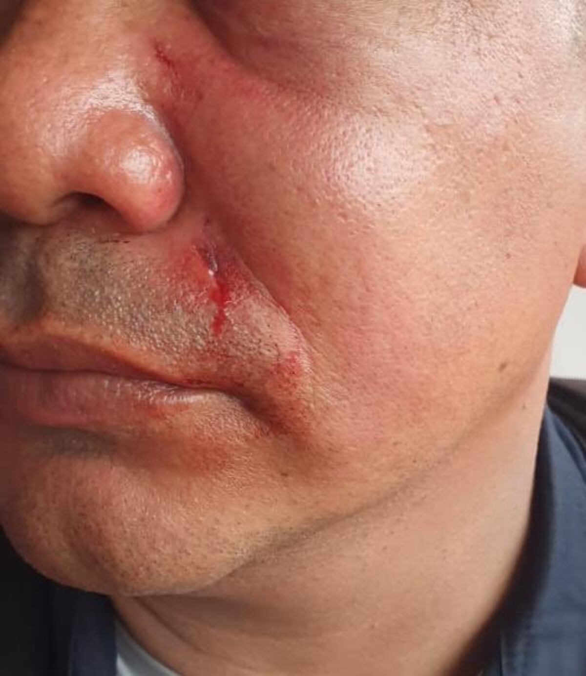 Hieren a policía que hacía cumplir la ley. Uno de los aprehendidos será querellado ante el Ministerio Público