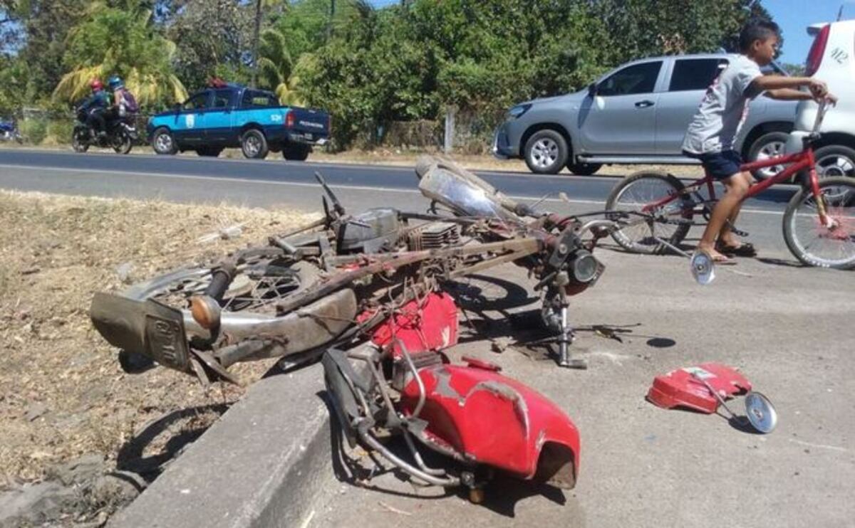 ¡QUÉ DOLOR! Mujer pierde la pierna en accidente de moto