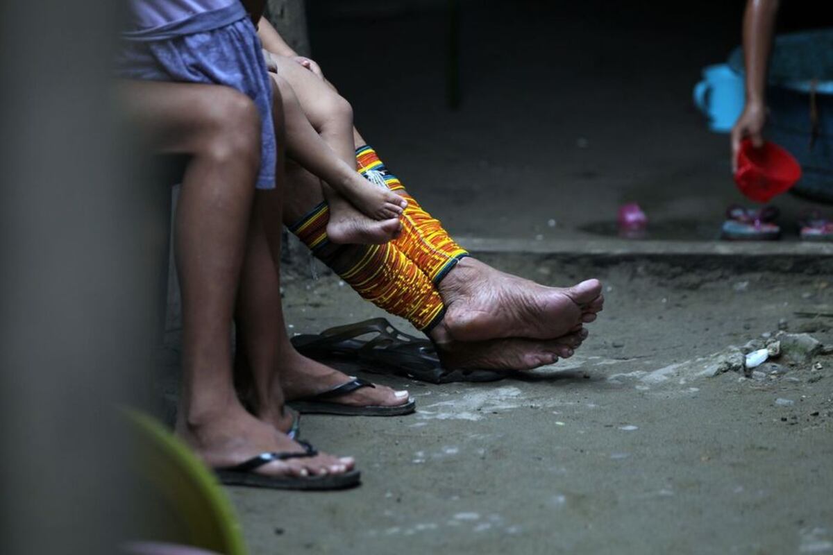 Mantienen alerta de vigilancia. Minsa confirma 67 casos de malaria y 37 de leishmaniasis