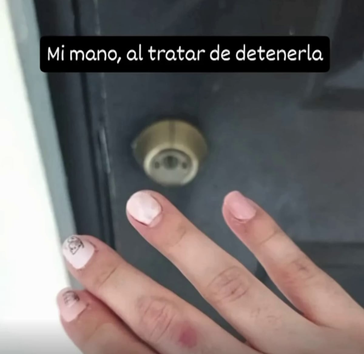 Ann Loraine denuncia presunta agresión de la nana de sus hijos y ella responde con otra versión