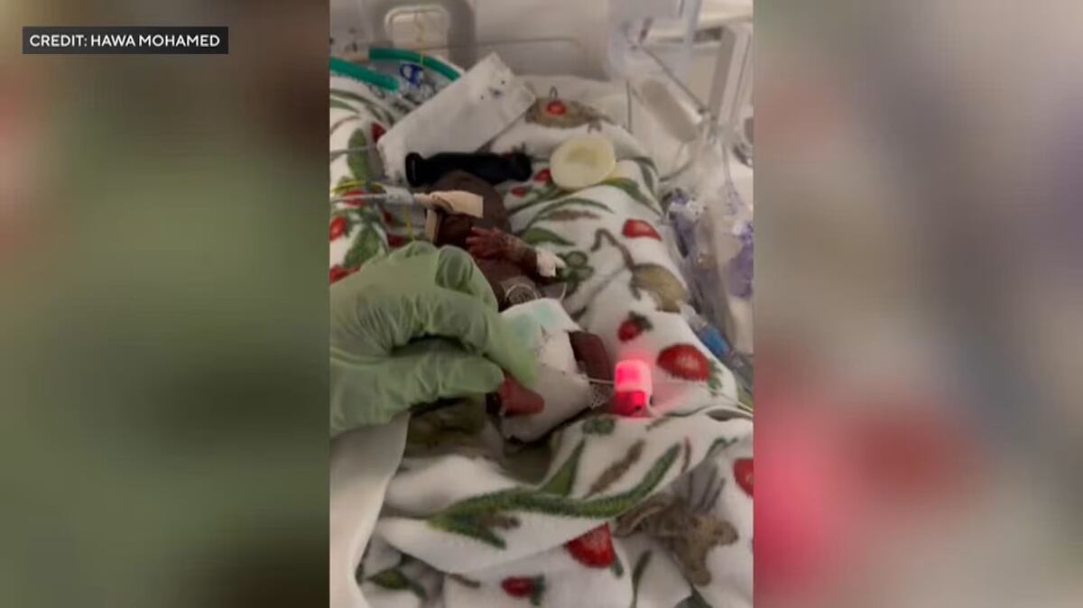 ¡Milagro chiquitito! Bebé que nació con 226 gramos ya está en casa