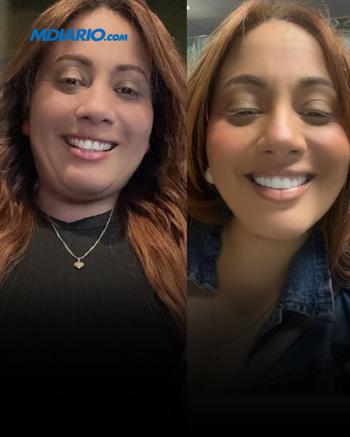 ¡Ahora sonríe y brilla! “La tía Yari” les tira con todo a los que se burlaban de sus dientes