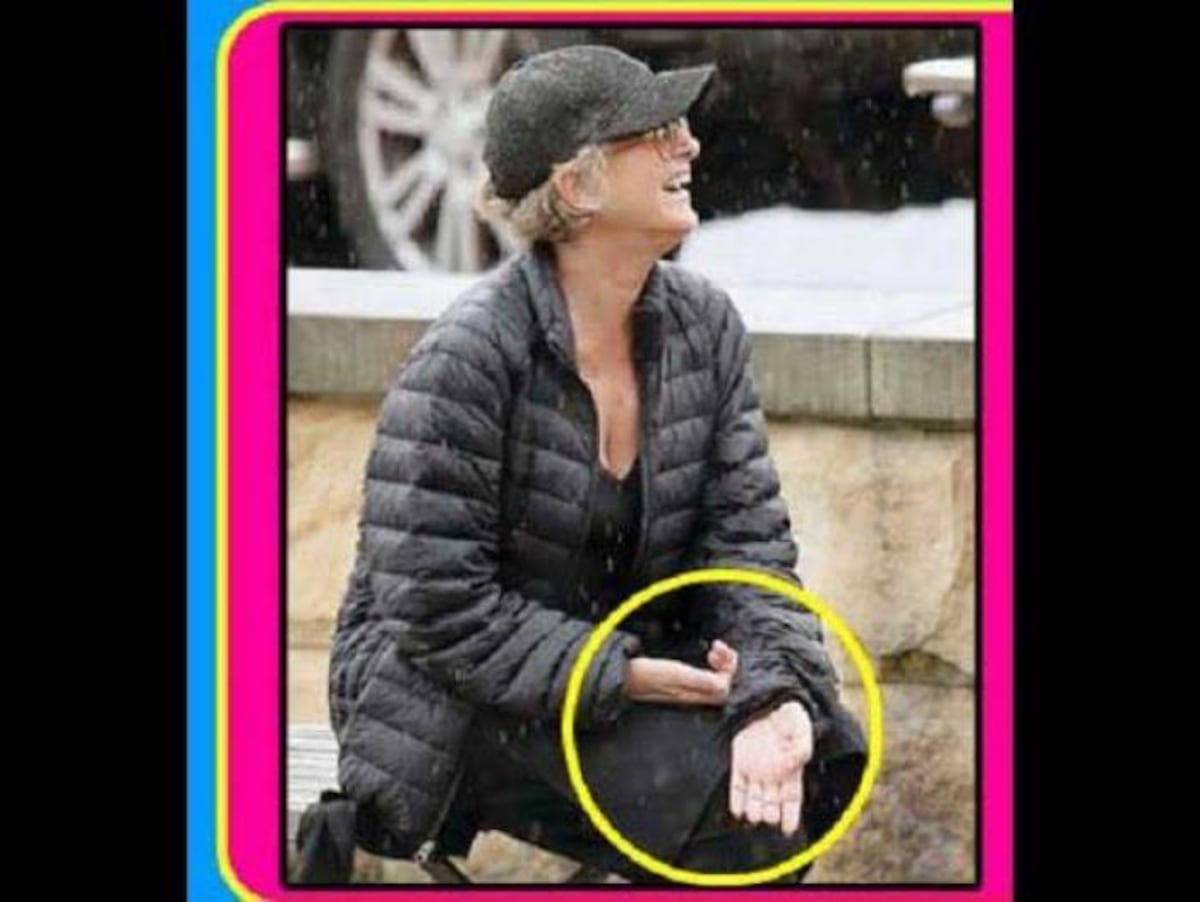 Esta sería la supuesta enfermedad que provocó el deceso de Christian Bach