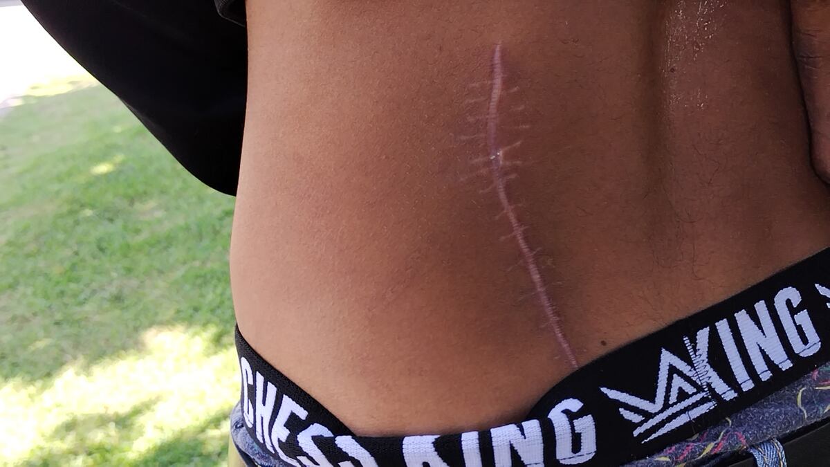 Hombre que mordió a una mujer da su versión y hasta interpuso denuncia por intento de homicidio