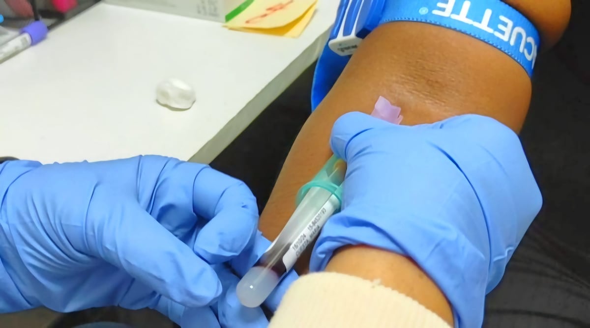 Si tienes antecedentes familiares, tu riesgo de cáncer de próstata es 10 veces mayor. No esperes más: hazte el examen.