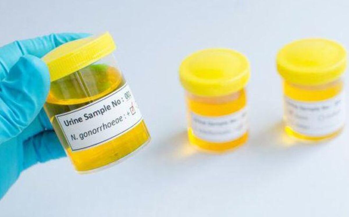 JUEGA VIVO EN CARNAVAL. 5 infecciones de transmisión sexual que dañan tus ojos