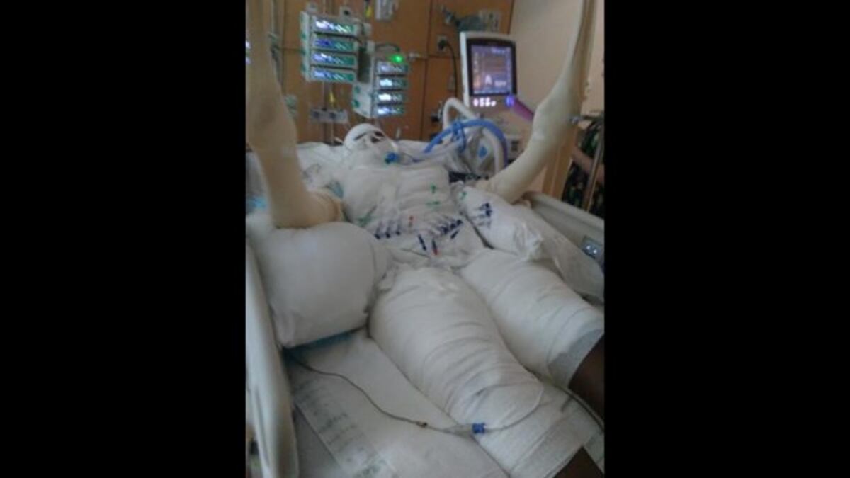 Madre de niña quemada pide a YouTube que censure los videos del 'Fire challenge'