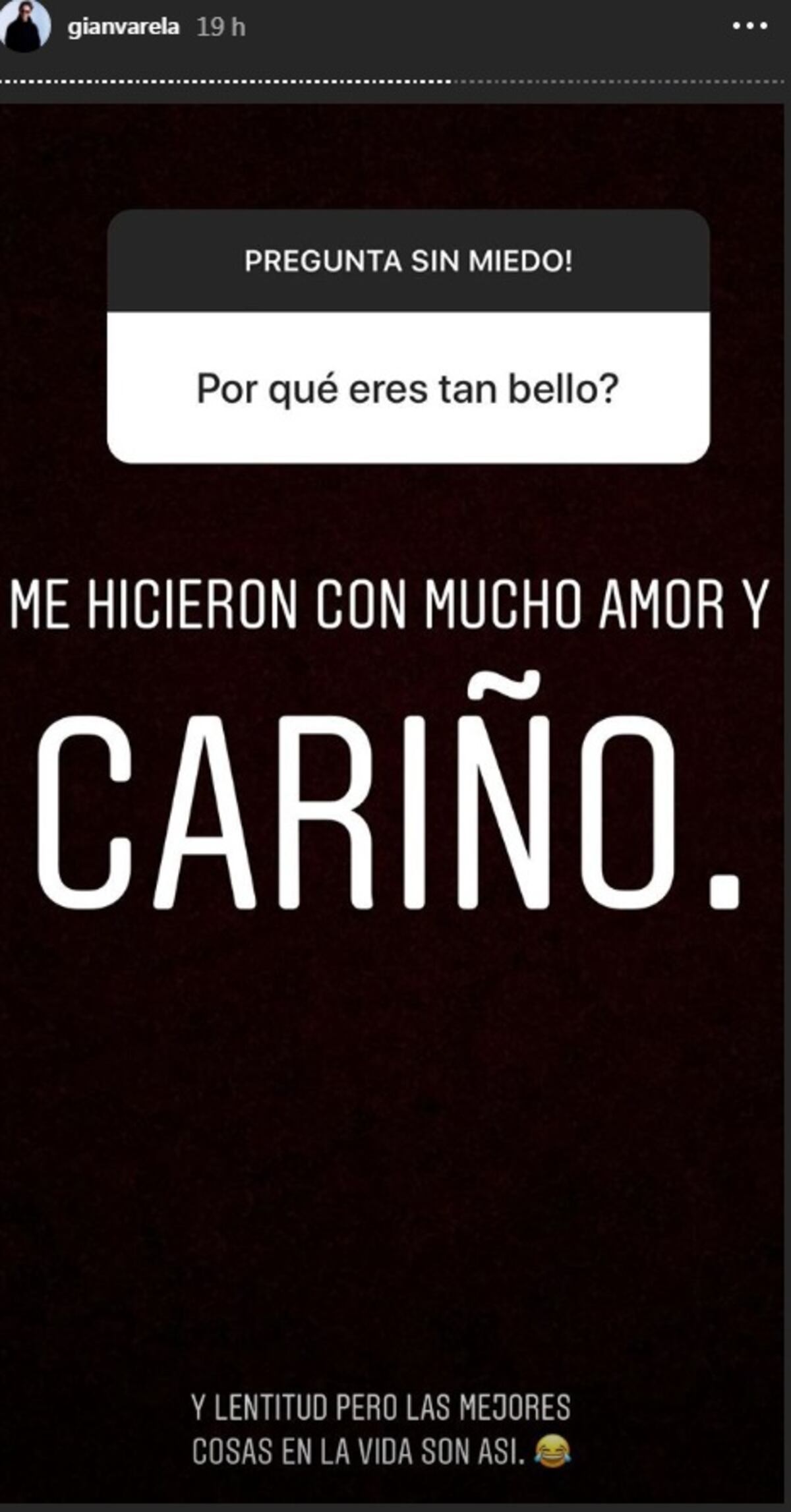 'Tener plata no te hace más jat':Gian Varela.Admite le dicen 'Tortuguín',pero...