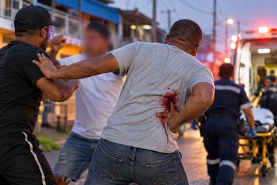 La sangre de Cristo. Se metió a separar una pelea y terminó apuñalado en Colón, pero se niega a decir quién fue
