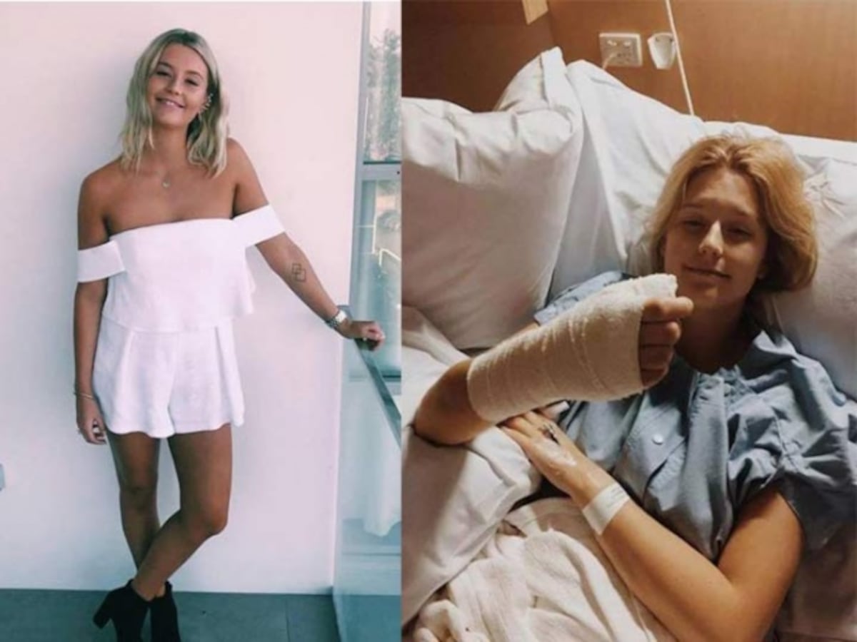 Joven desarrolla extraño tipo de cáncer por morderse las uñas