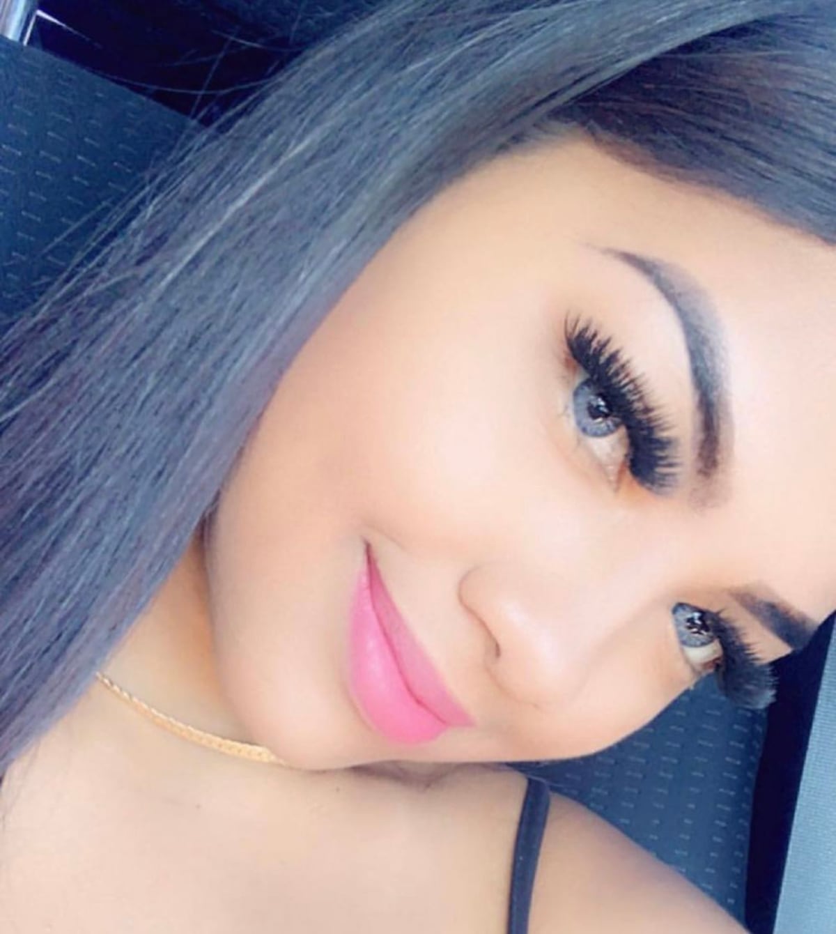 Anyuri mostró su nueva nariz. Mira un antes y después de su transformación 