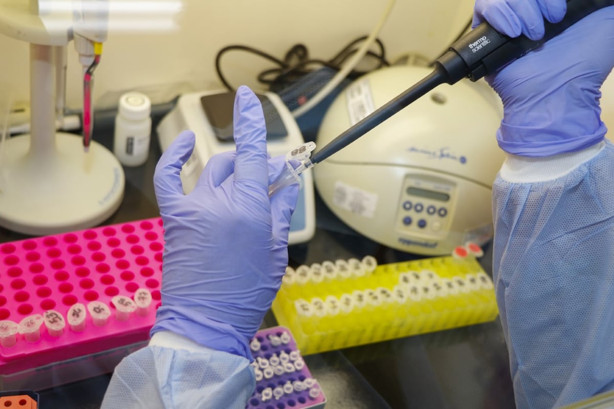 Estudian segundo caso sospechoso de hepatitis aguda en Panamá