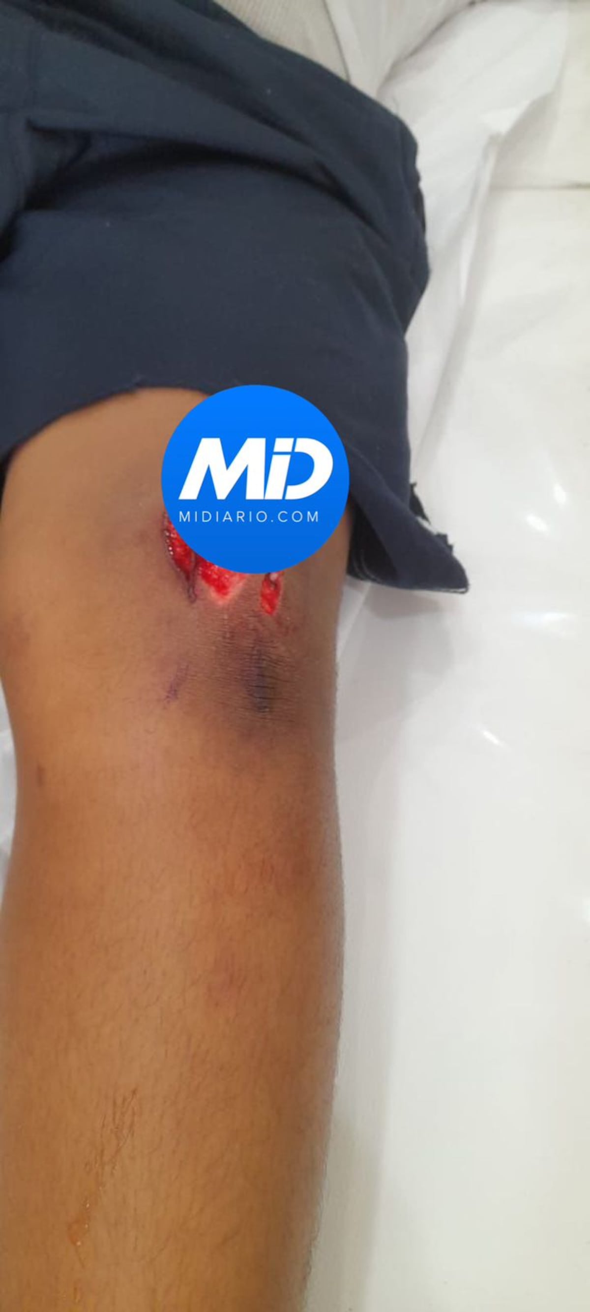 Estudiante se accidenta en centro comercial convertido en colegio