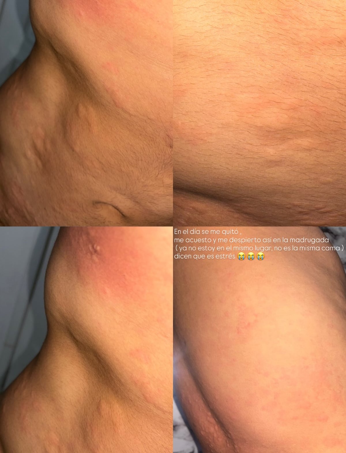 ‘Ya el cuerpo tá hablando’: Yedgar cuenta su susto de salud y promete tomarse las cosas con calma + Videos
