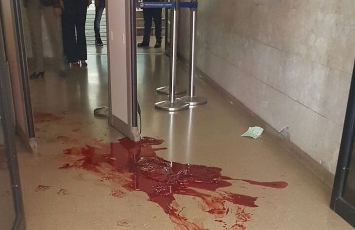 Maleantes hieren en la cabeza a policía cerca a la DGI