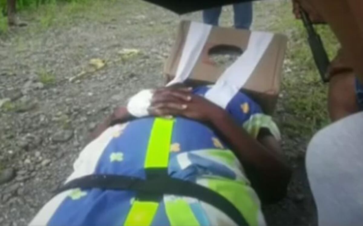 Mujer que quemó con ácido a su cuñada por celos fue enviada a la cárcel