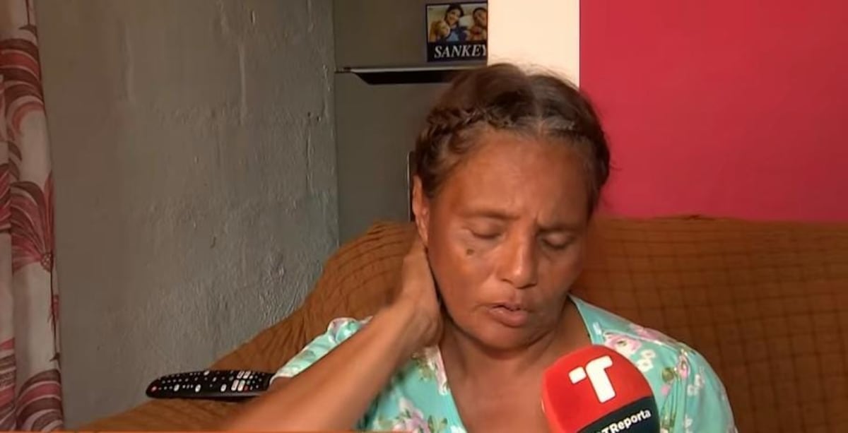 ‘Dios me dio otra oportunidad’: trabajadora de aseo relata cómo el bus las atropelló