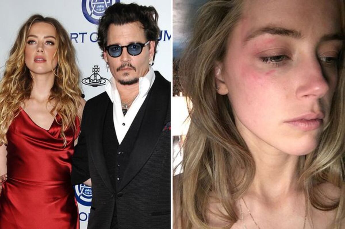 El actor Johnny Depp aseguró que su exesposa le pegó en el rostro