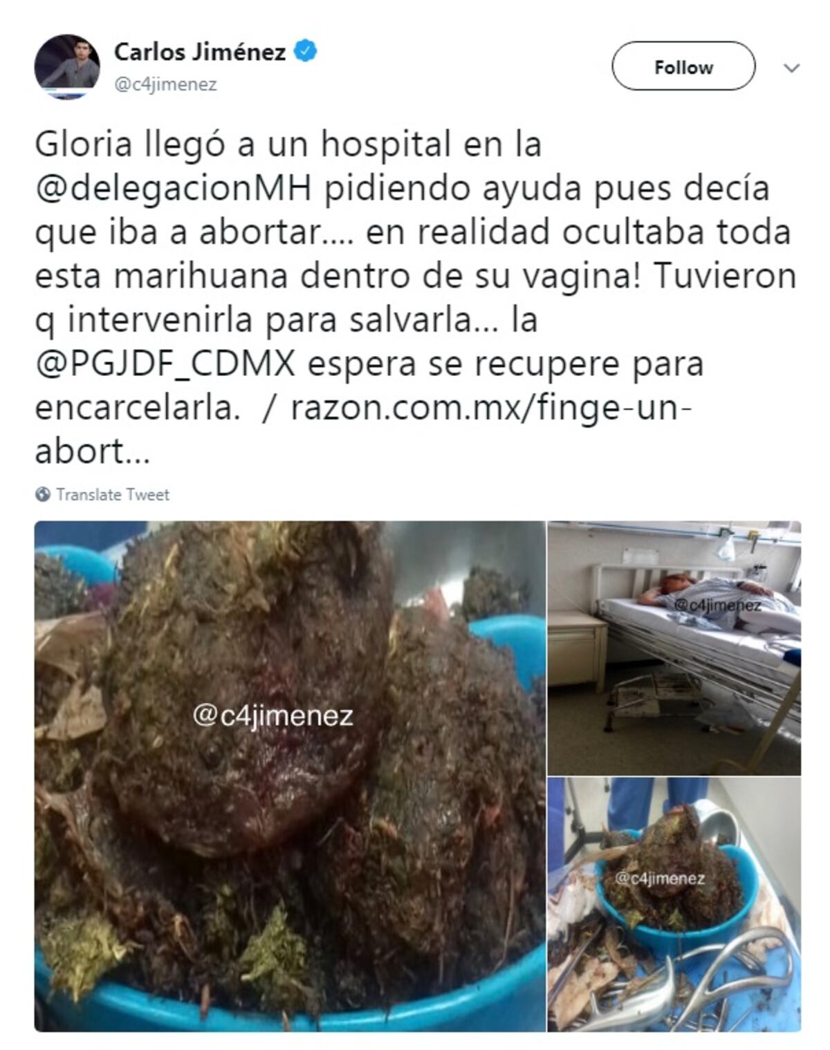 Esta mujer fingió un aborto y le extrajeron droga de su vientre