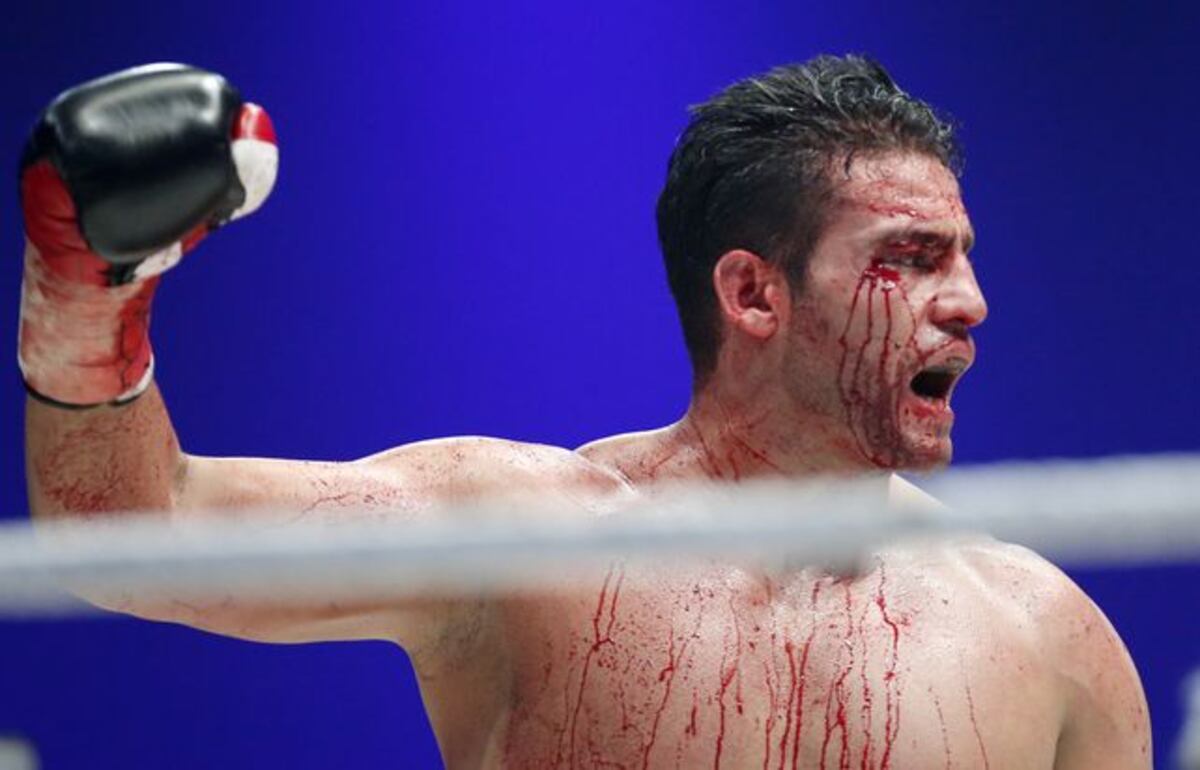 Otro campeón mundial de boxeo da positivo en doping