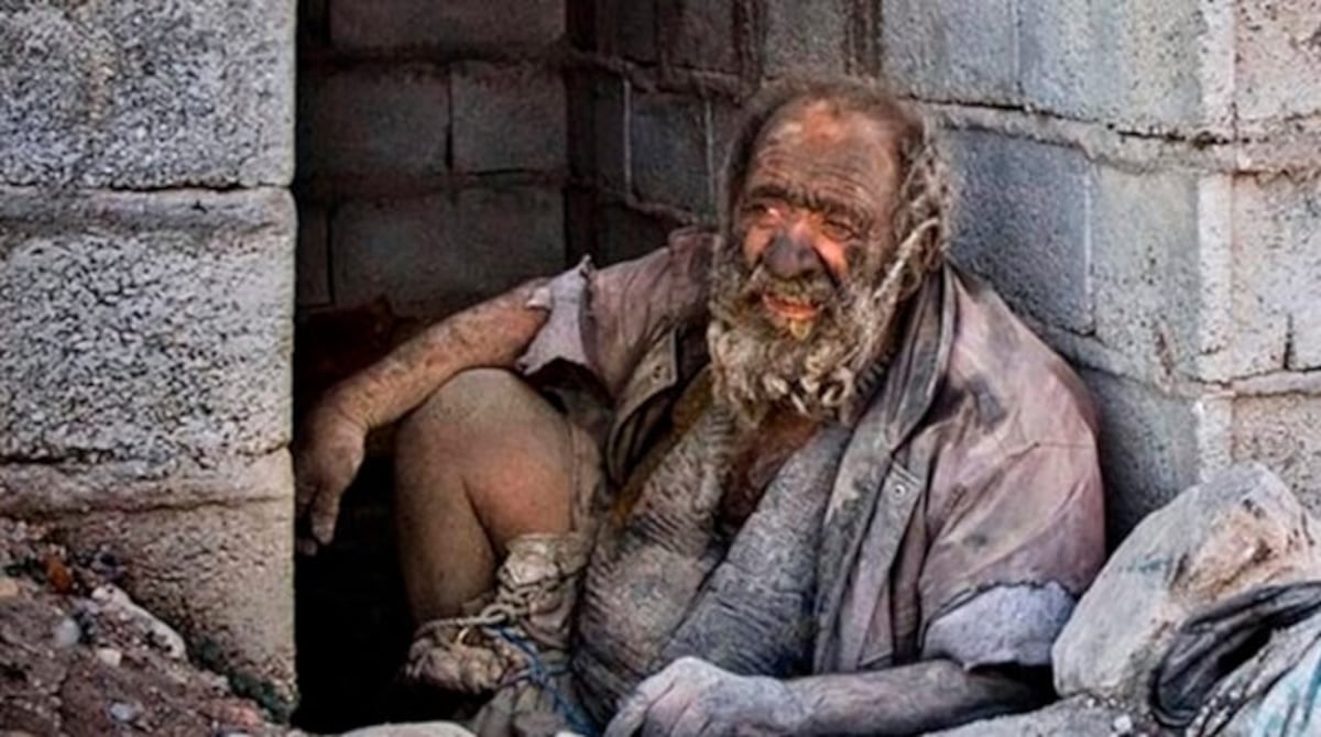 Fallece el hombre más sucio del mundo que le tenía miedo al agua y al jabón