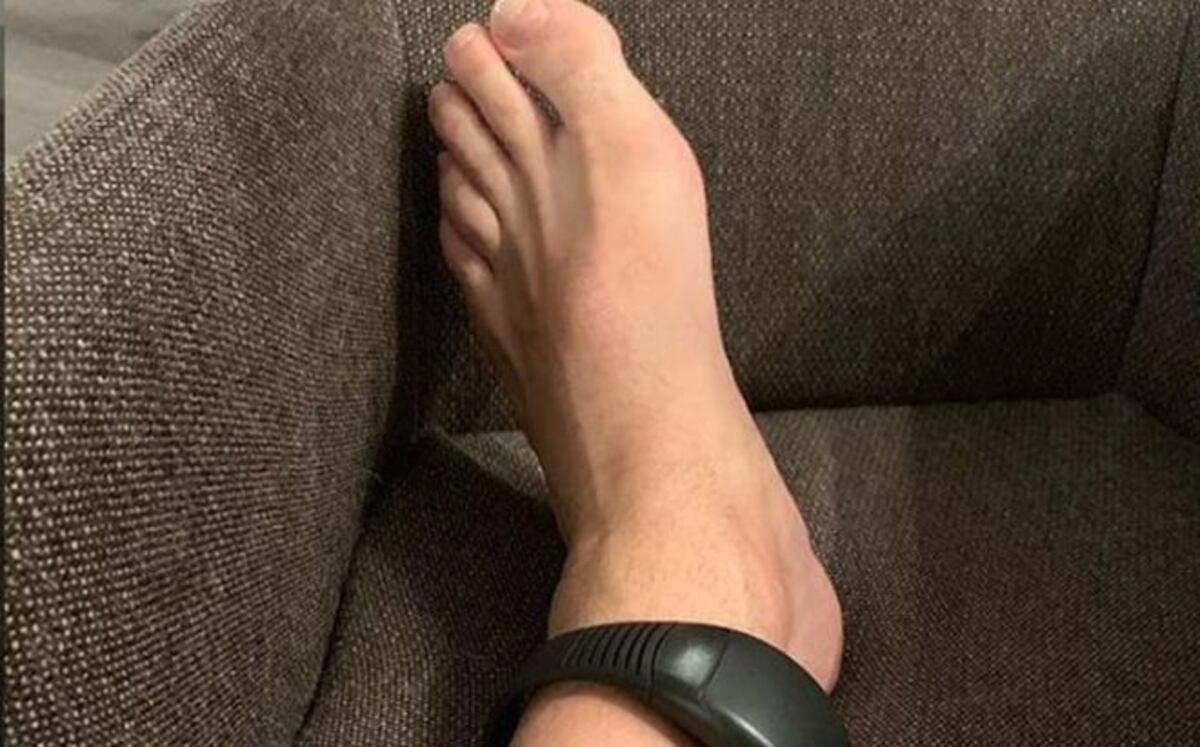 Jugador ‘presume’ condena con tobillera electrónica