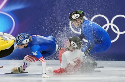 Lesión en el ojo de Kamila Sellier estremece Milán