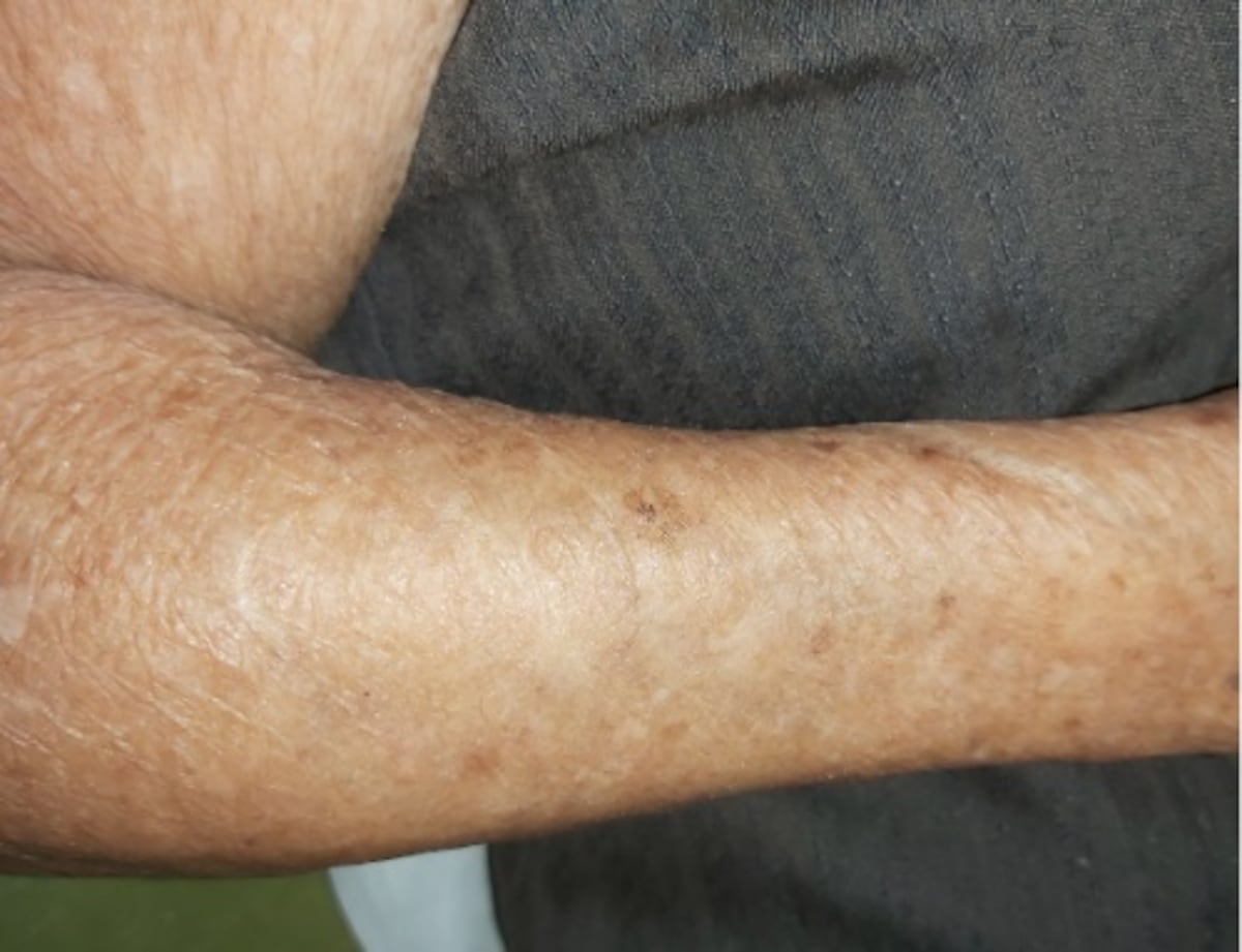 Le explicamos por qué los adultos mayores solo deben darse un baño al día