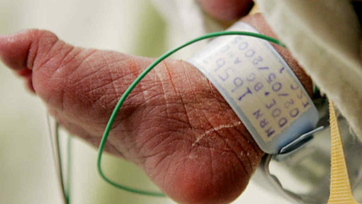 Los médicos quieren ‘liberar’ a esta bebé del sufrimiento. Padres tienen 10 días para mantenerla con vida