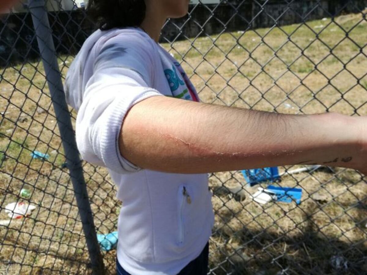 AY, POR DIOS! Parada se desploma mientras esperaban el bus | VIDEO