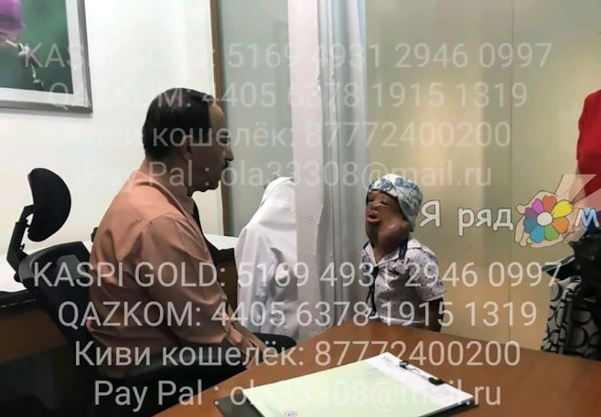 Pide en una carta que le regalen un rostro nuevo para no asustar a las personas