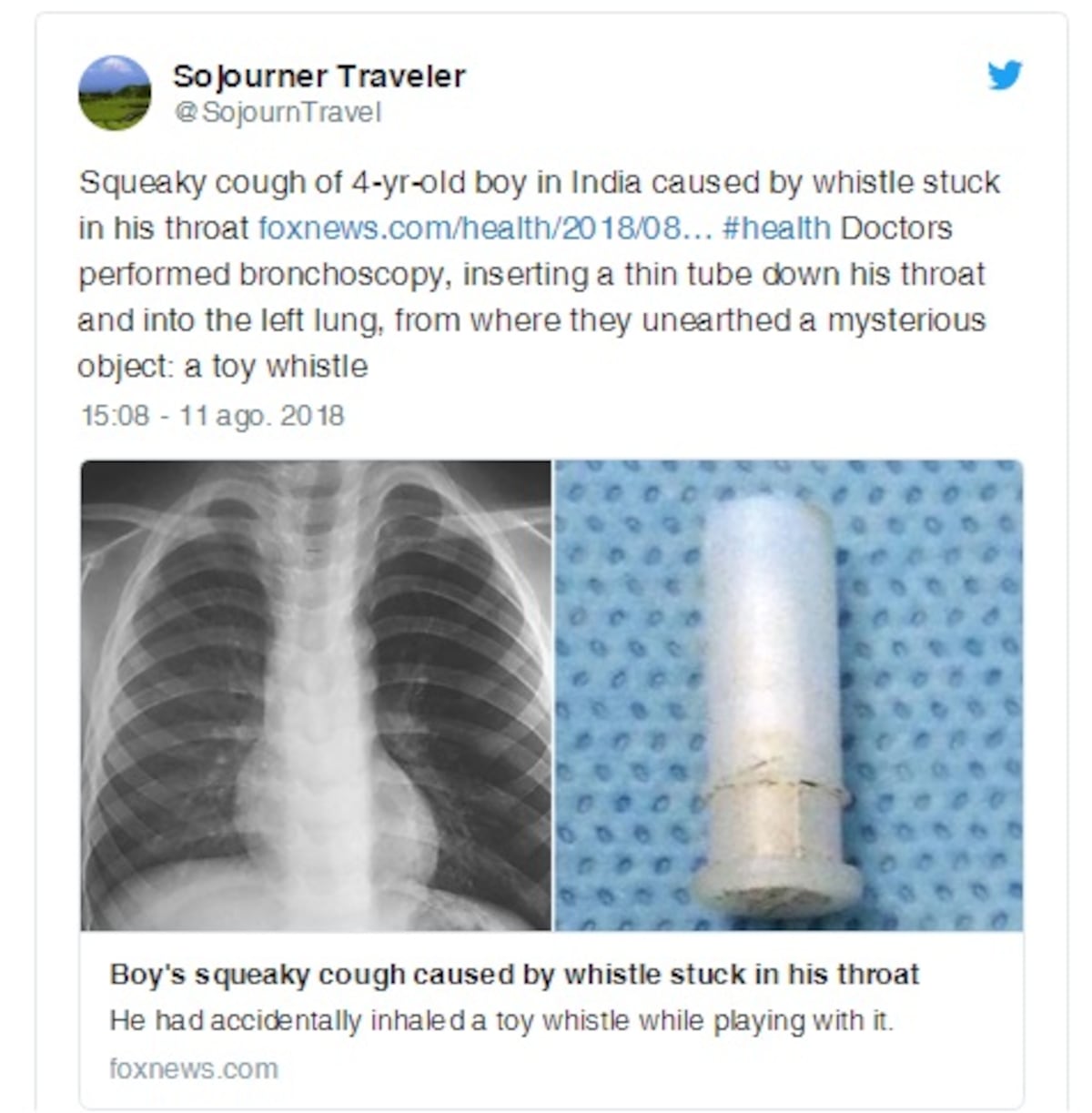 Niño tosía de modo extraño y al llevarlo a un hospital descubrieron el porqué