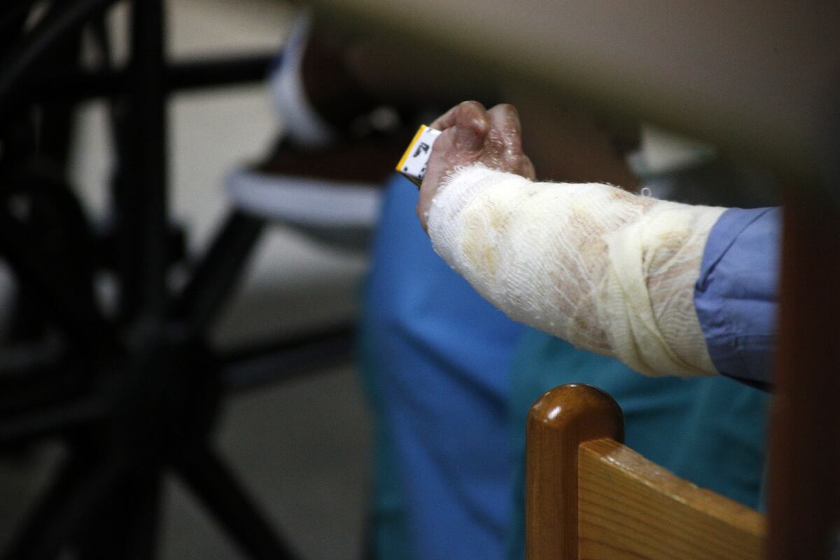 Niño quiso imitar video de Bad Bunny y falleció tras sufrir quemaduras