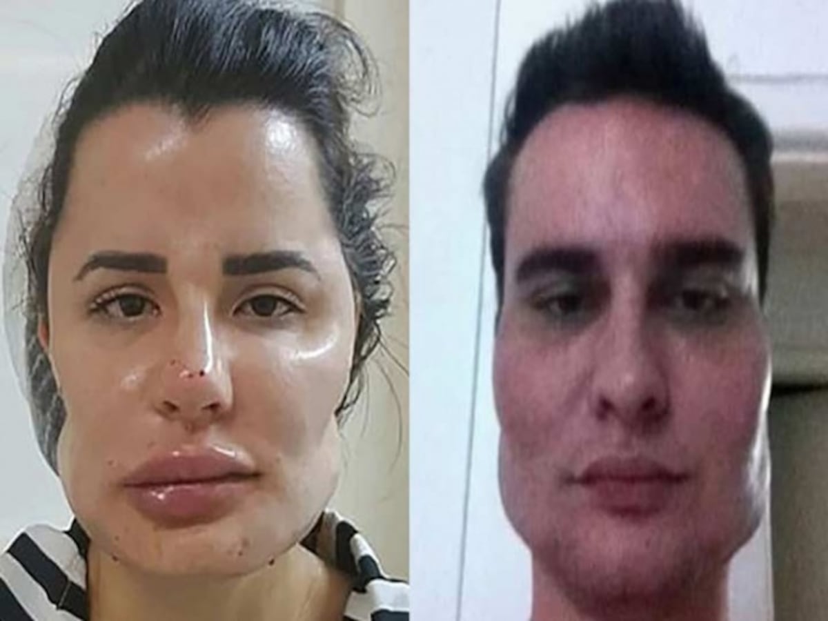 Cirujano inyectó sustancias prohibidas y deformó a pacientes