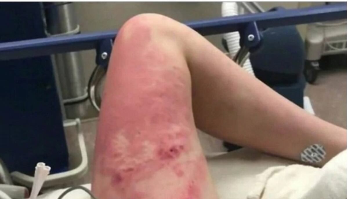 El impactante video que muestra como una joven fue empujada desde un puente