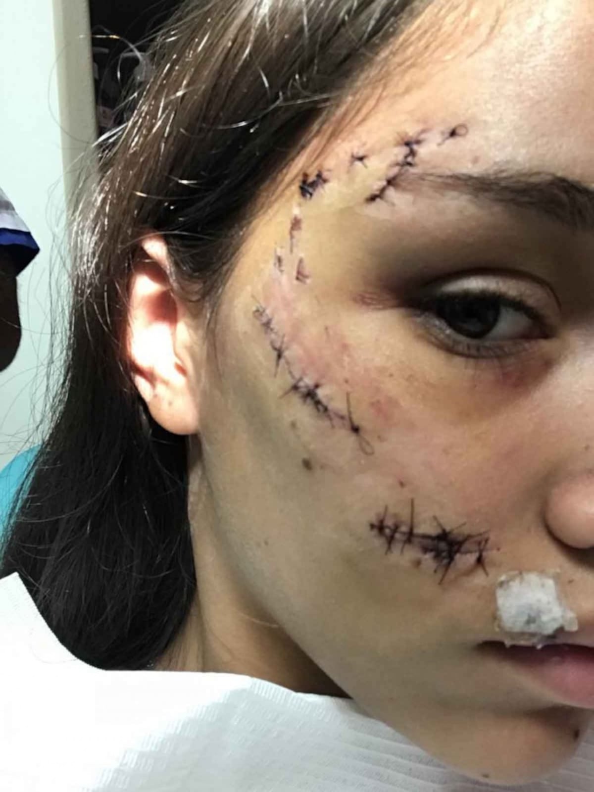 Intentó hacerse ‘selfie’ con su perro, la atacó y así quedó su cara