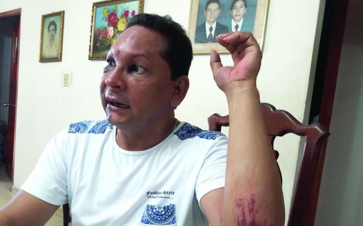 TREMENDA GOLPIZA. Después de salir de la discoteca en La Chorrera 