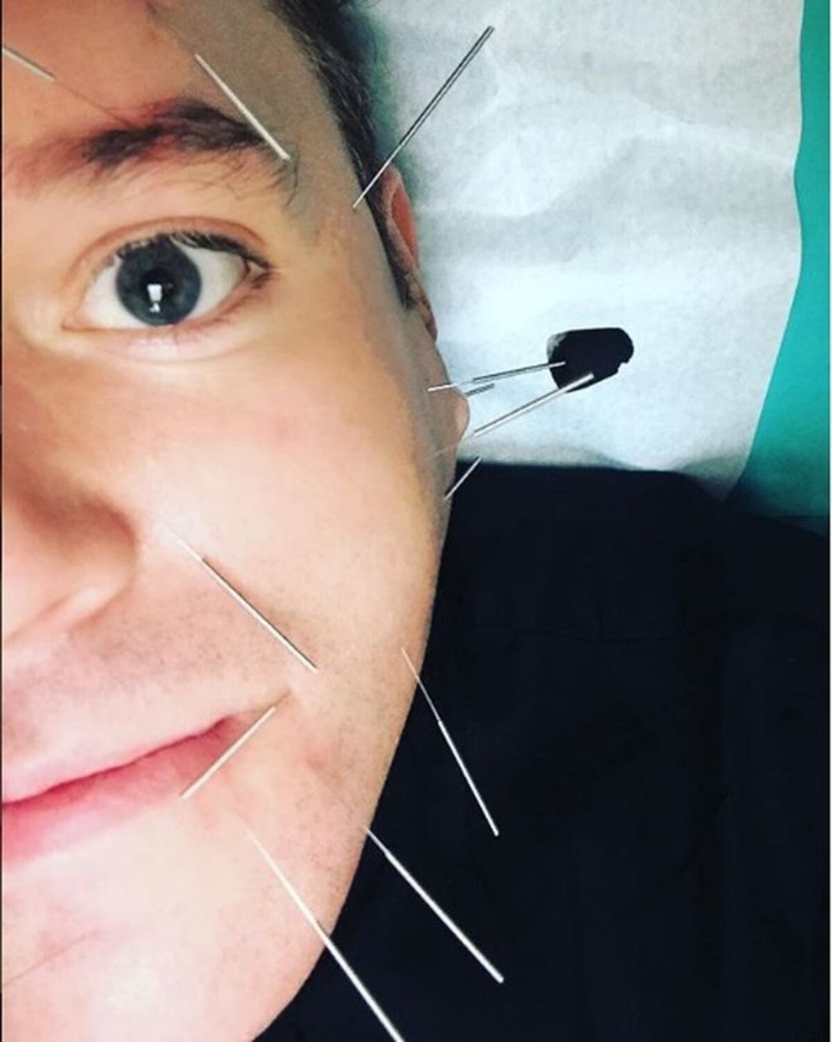 Hasta un curandero le recomiendan a Alex Medela. Ya ha mejorado