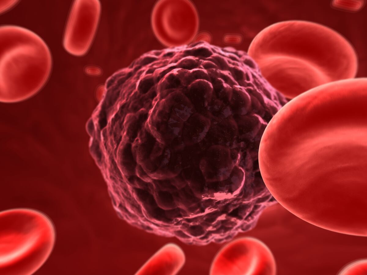 Hemofilia: una enfermedad mayormente hereditaria y padecida más por los hombres