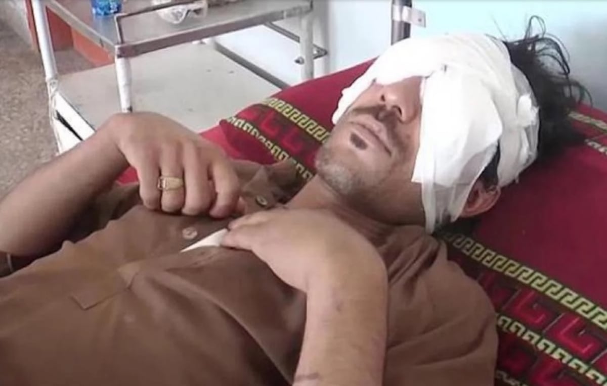 ¡QUÉ FUERTE! En Pakistán a un hombre le sacan los ojos por querer casarse